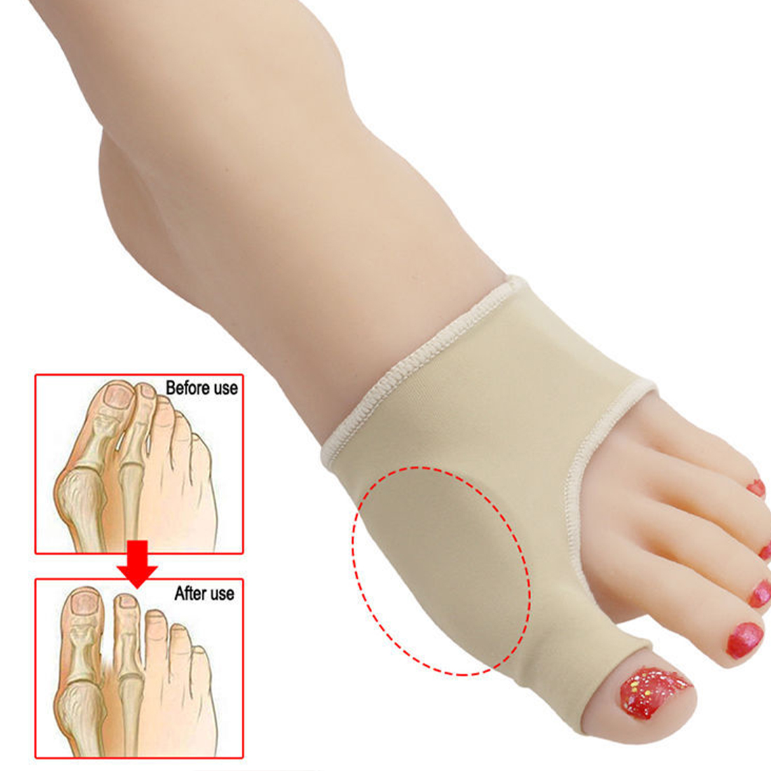 Toe Splint Straightener For Hammer Toe Corrector Crooked Toe Claw Toe Stabilizer Support Feet Corrector Pain Relief Toe Splint Straightener For Hammer Toe Corrector Crooked Toe Claw Toe Stabilizer Support Feet Corrector Pain Relief