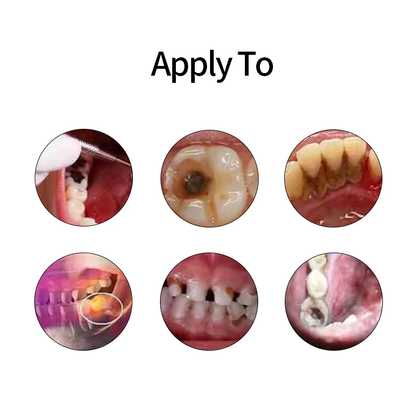 Toothpaste For Plaque Removal Quick Repair Of Cavities Deep Cleaning Removal Of Tartar Whitening Of Teeth Fresh Breath
