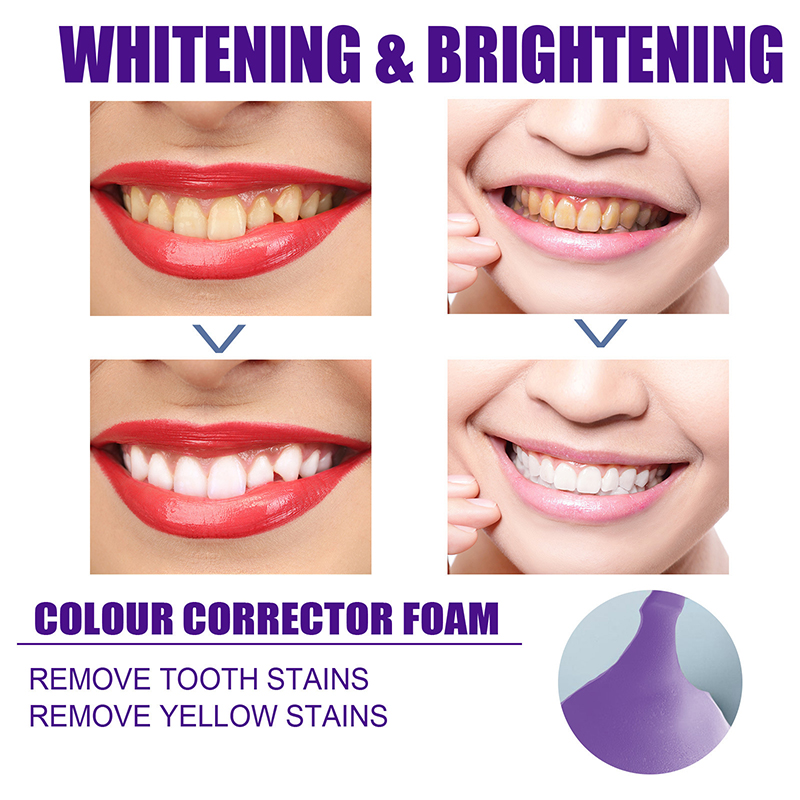 Toothpaste Mousse V34 Teeth Cleaning Effective Whitening Toothpaste Yellow Teeth Removing Tooth Stain Oral Cleaning Toothpaste Mousse V34 Teeth Cleaning Effective Whitening Toothpaste Yellow Teeth Removing Tooth Stain Oral Cleaning