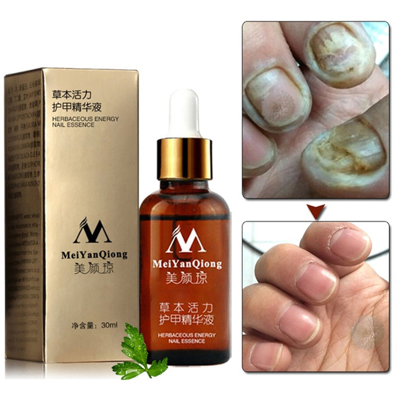 Topical Antifungal Nail Care Oil Topical Antifungal Nail Care Oil