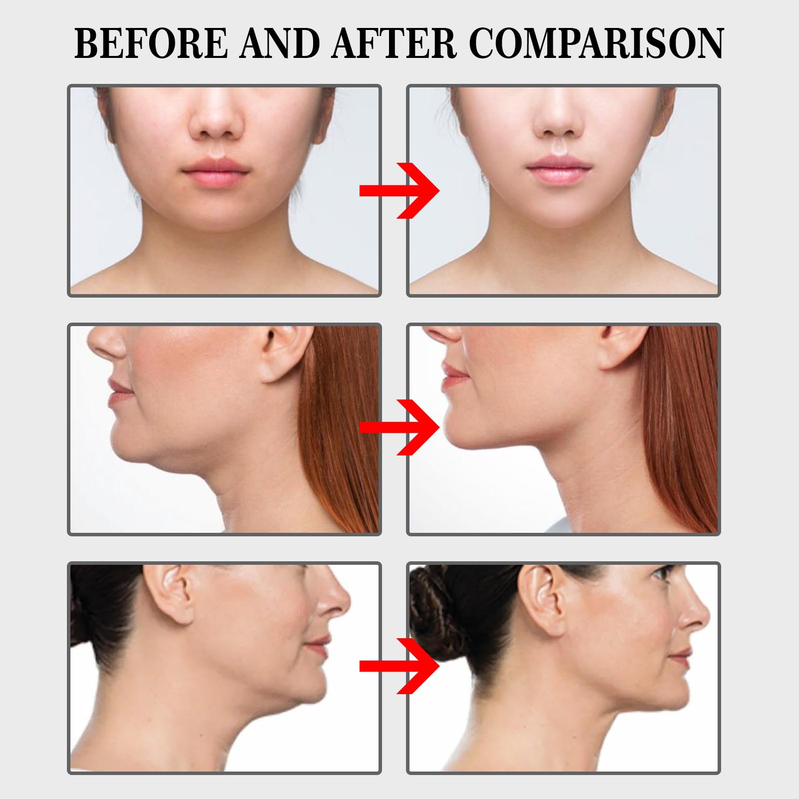 Transparent Anti Wrinkle Pads (100 pcs) Transparent Anti Wrinkle Pads (100 pcs)