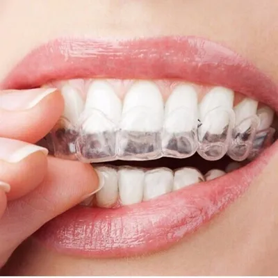 Transparent Night Guard Gum Shield Mouth Trays For Bruxism Teeth Whitening Grinding for Boxing Teeth Protection Transparent Night Guard Gum Shield Mouth Trays For Bruxism Teeth Whitening Grinding for Boxing Teeth Protection