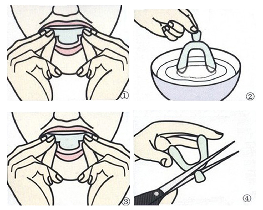 Transparent Night Guard Gum Shield Mouth Trays For Bruxism Teeth Whitening Grinding for Boxing Teeth Protection Transparent Night Guard Gum Shield Mouth Trays For Bruxism Teeth Whitening Grinding for Boxing Teeth Protection