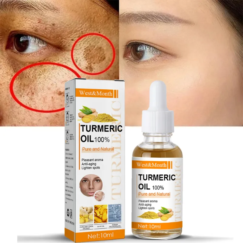 Turmeric Remove Dark Spots Essential Oil Anti wrinkle Serum 100% Pure Therapeutic Grade Face Whitening Moisturizing Turmeric Remove Dark Spots Essential Oil Anti wrinkle Serum 100% Pure Therapeutic Grade Face Whitening Moisturizing