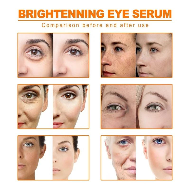 Turmeric Remove Dark Spots Essential Oil Anti wrinkle Serum 100% Pure Therapeutic Grade Face Whitening Moisturizing Turmeric Remove Dark Spots Essential Oil Anti wrinkle Serum 100% Pure Therapeutic Grade Face Whitening Moisturizing