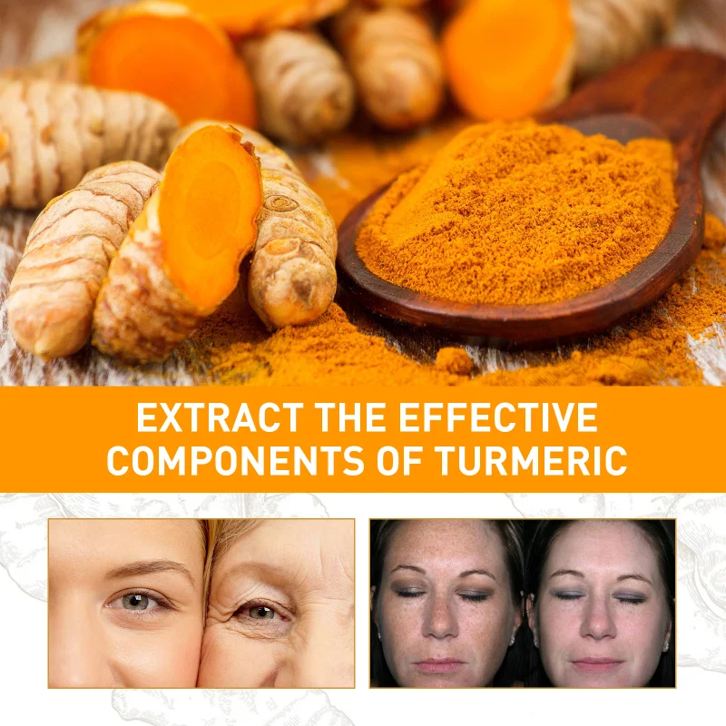 Turmeric Remove Dark Spots Essential Oil Anti wrinkle Serum 100% Pure Therapeutic Grade Face Whitening Moisturizing Turmeric Remove Dark Spots Essential Oil Anti wrinkle Serum 100% Pure Therapeutic Grade Face Whitening Moisturizing