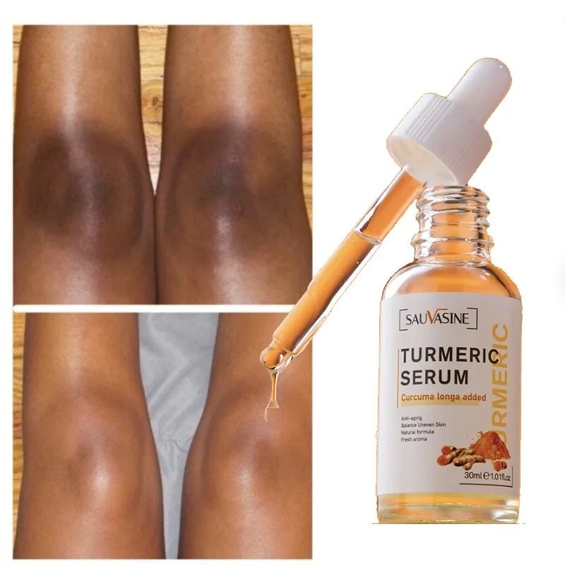 Turmeric Serum Skin Glow To Lightening Face Hand Bright Dark Spots Corrector Dark Patches Beauty Health Acne Whitening