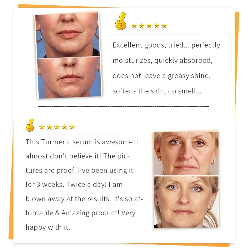 Turmeric Serum Skin Glow To Lightening Face Hand Bright Dark Spots Corrector Dark Patches Beauty Health Acne Whitening Turmeric Serum Skin Glow To Lightening Face Hand Bright Dark Spots Corrector Dark Patches Beauty Health Acne Whitening