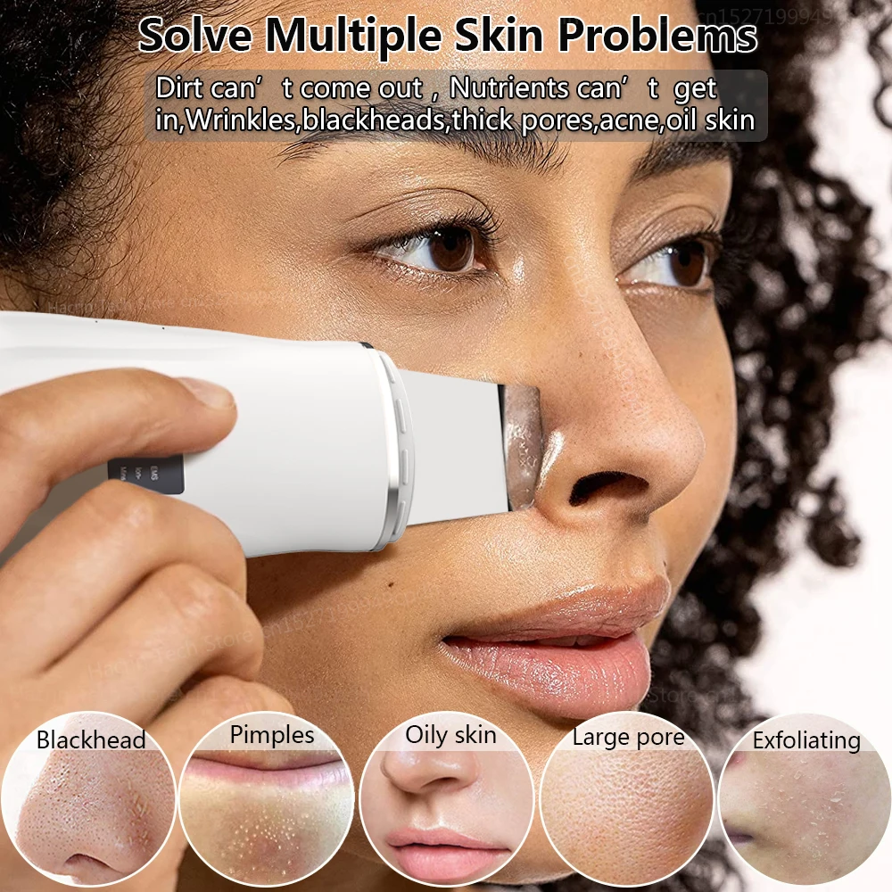 Ultrasonic Peeling Remover Blackhead Facial Skin Scrubber Facial Shovel Deep Cleaning Face Lifting Removal Pore Acne