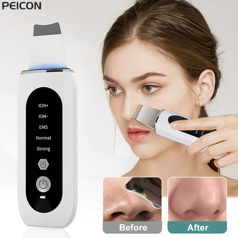Ultrasonic Skin Scrubber Peeling Blackhead Remover Deep Face Cleaning Ultrasonic Ion Ance Pore Cleaner Facial Shovel Ultrasonic Skin Scrubber Peeling Blackhead Remover Deep Face Cleaning Ultrasonic Ion Ance Pore Cleaner Facial Shovel