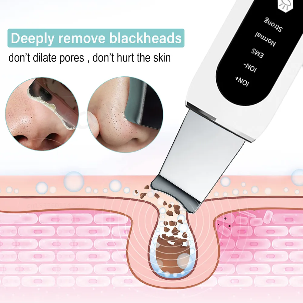 Ultrasonic Skin Scrubber Peeling Blackhead Remover Deep Face Cleaning Ultrasonic Ion Ance Pore Cleaner Facial Shovel Ultrasonic Skin Scrubber Peeling Blackhead Remover Deep Face Cleaning Ultrasonic Ion Ance Pore Cleaner Facial Shovel