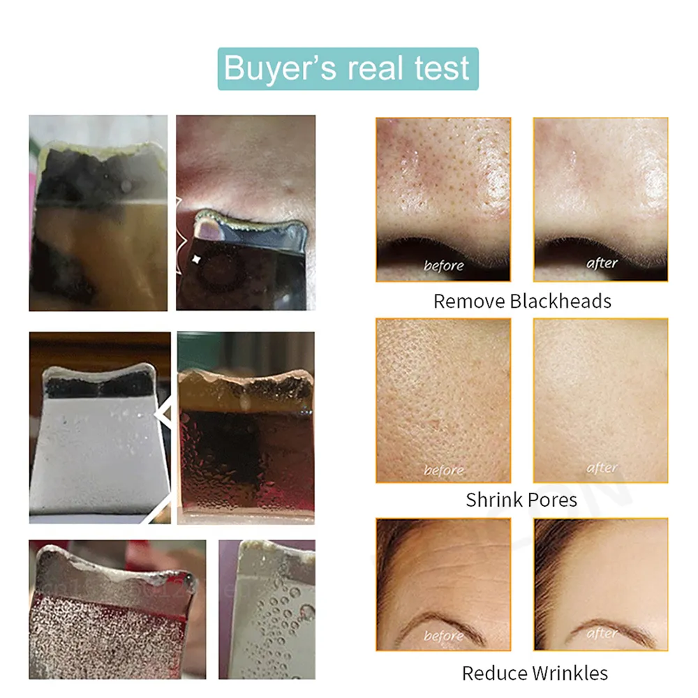 Ultrasonic Skin Scrubber Peeling Blackhead Remover Deep Face Cleaning Ultrasonic Ion Ance Pore Cleaner Facial Shovel Ultrasonic Skin Scrubber Peeling Blackhead Remover Deep Face Cleaning Ultrasonic Ion Ance Pore Cleaner Facial Shovel