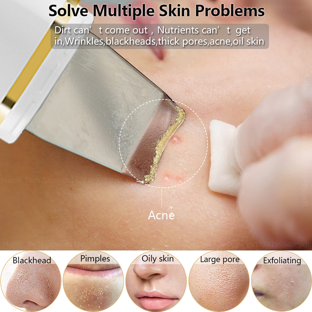 Ultrasonic Skin Scrubber Remover Blackhead Ultrasonic Peeling Facial Scrubber Shovel Deep Cleaning Face Lifting Remove Ultrasonic Skin Scrubber Remover Blackhead Ultrasonic Peeling Facial Scrubber Shovel Deep Cleaning Face Lifting Remove