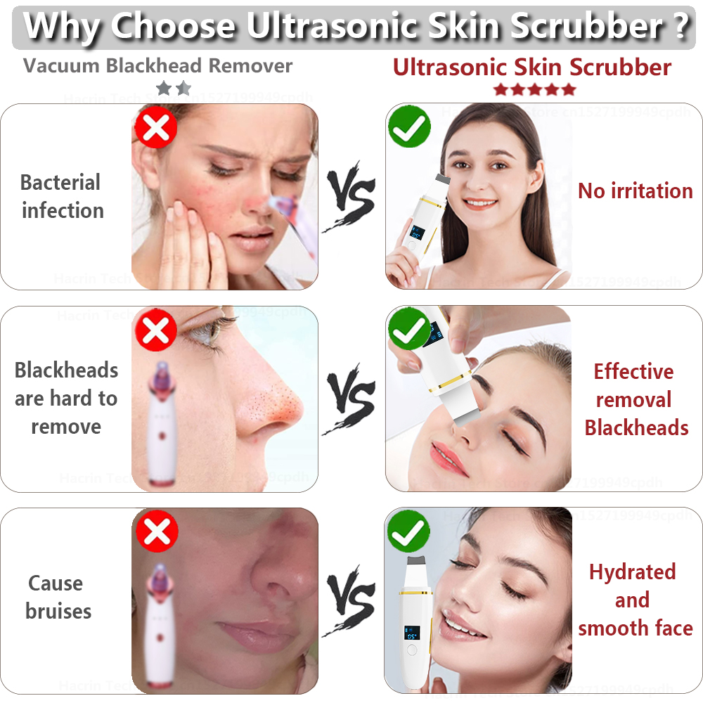 Ultrasonic Skin Scrubber Remover Blackhead Ultrasonic Peeling Facial Scrubber Shovel Deep Cleaning Face Lifting Remove Ultrasonic Skin Scrubber Remover Blackhead Ultrasonic Peeling Facial Scrubber Shovel Deep Cleaning Face Lifting Remove