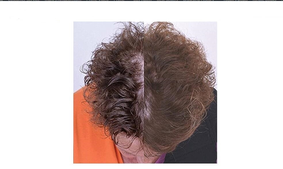 USB Powered Laser Hair Growth Cap USB Powered Laser Hair Growth Cap