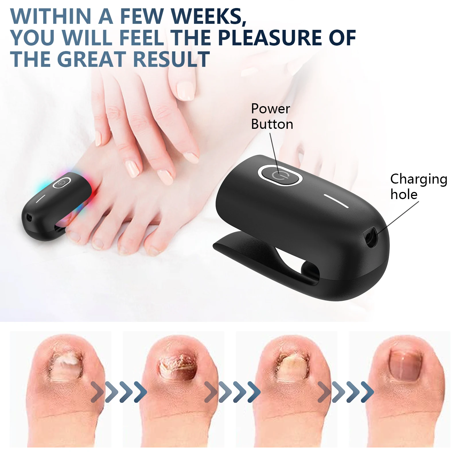USB Rechargeable Nail Fungus Laser Device Toenail Laser Therapy Machine Anti Fungal Laser Equipment for Onychomycosis