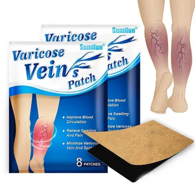 Varicose Veins Patches