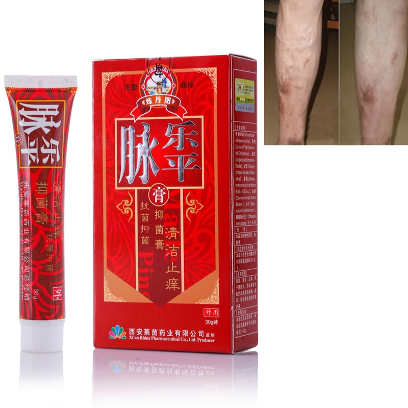 Varicose Veins Treatment Cream Herbal Formula Varicose Veins Treatment Cream Herbal Formula