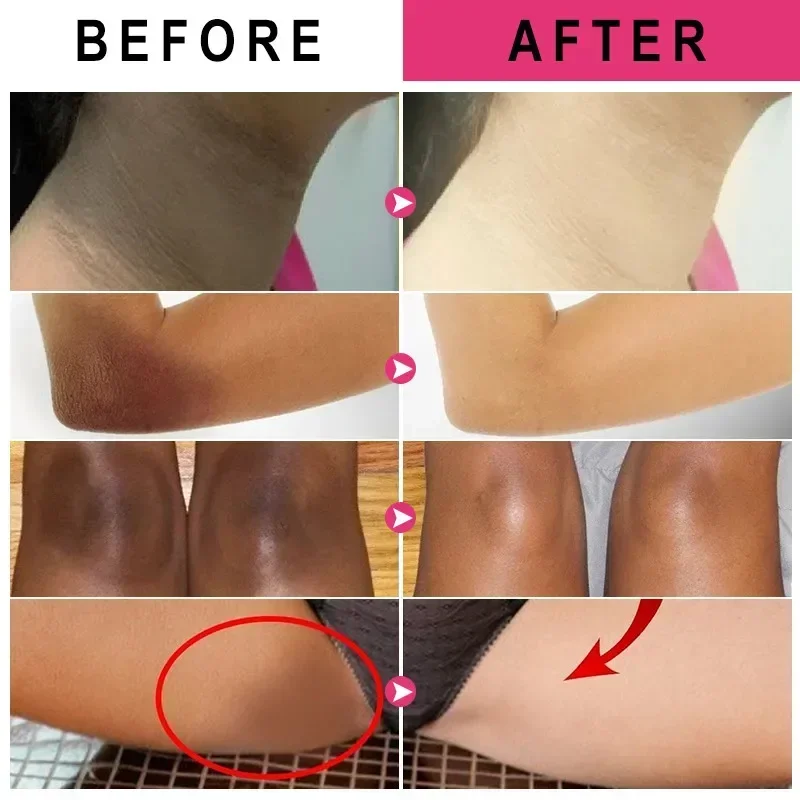Vitamin C Brighten Cream Brightening Skin Cream Lightening Melanin Bleaching Armpits Elbows Knees Moisturizing Body