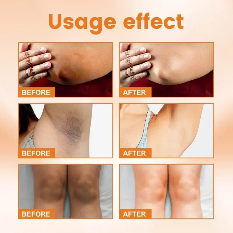Vitamin C Brighten Cream Brightening Skin Cream Lightening Melanin Bleaching Armpits Elbows Knees Moisturizing Body