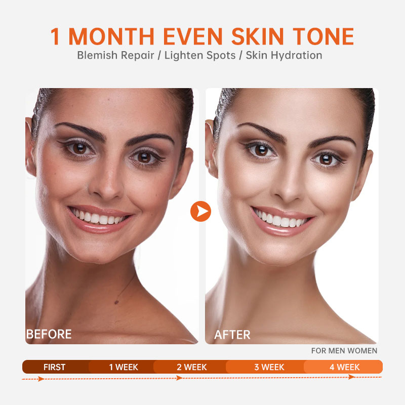 Vitamin C Face Serum Whitening Anti Dark Spot Hyaluronic Acid Facial Essence Skin Care Beauty Health