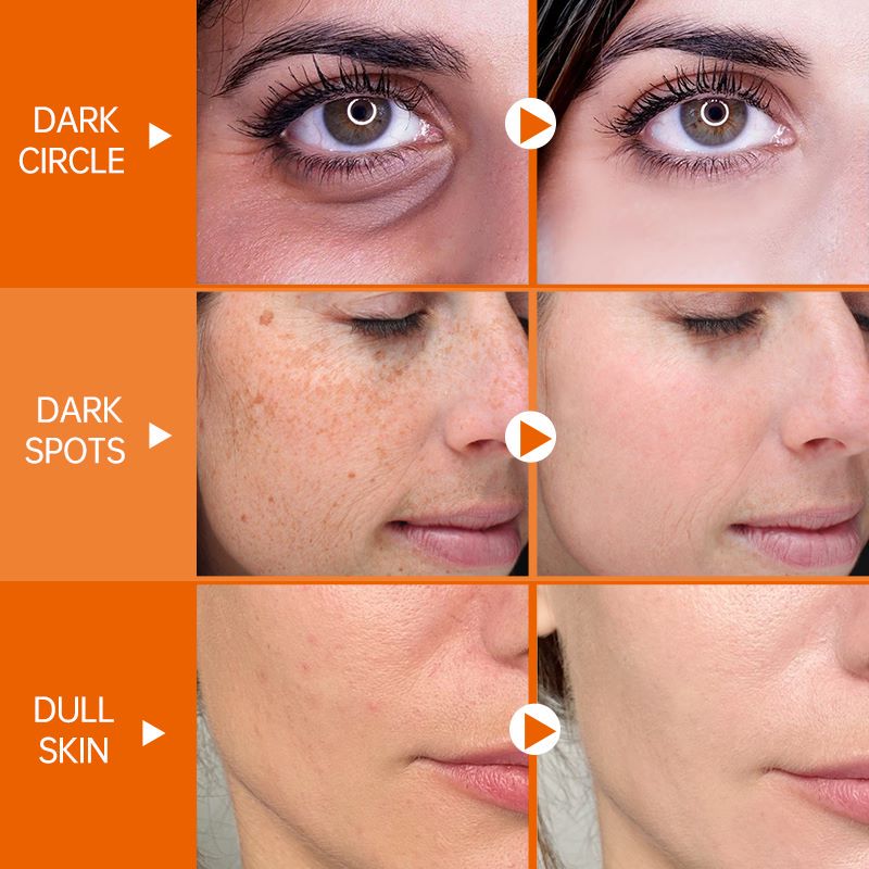 Vitamin C Face Serum Whitening Anti Dark Spot Hyaluronic Acid Facial Essence Skin Care Beauty Health