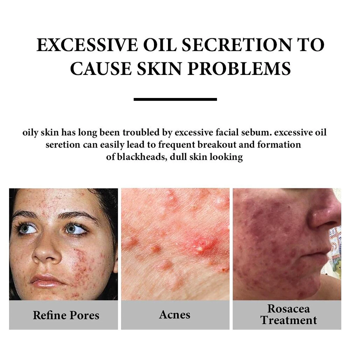 Vitamin C Serum For Face Moisturizing Brightens Skin Repair Smooth Facial Essence Serum Facial Care Skincare Products Vitamin C Serum For Face Moisturizing Brightens Skin Repair Smooth Facial Essence Serum Facial Care Skincare Products