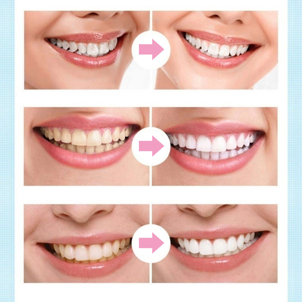 Whitening Teeth Pen Oral Care