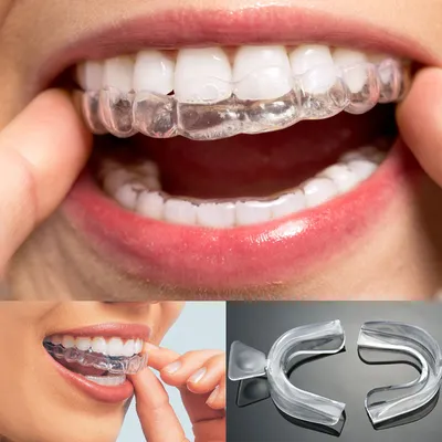 Whitening Teeth Trays 5 Pairs Whitening Teeth Trays 5 Pairs