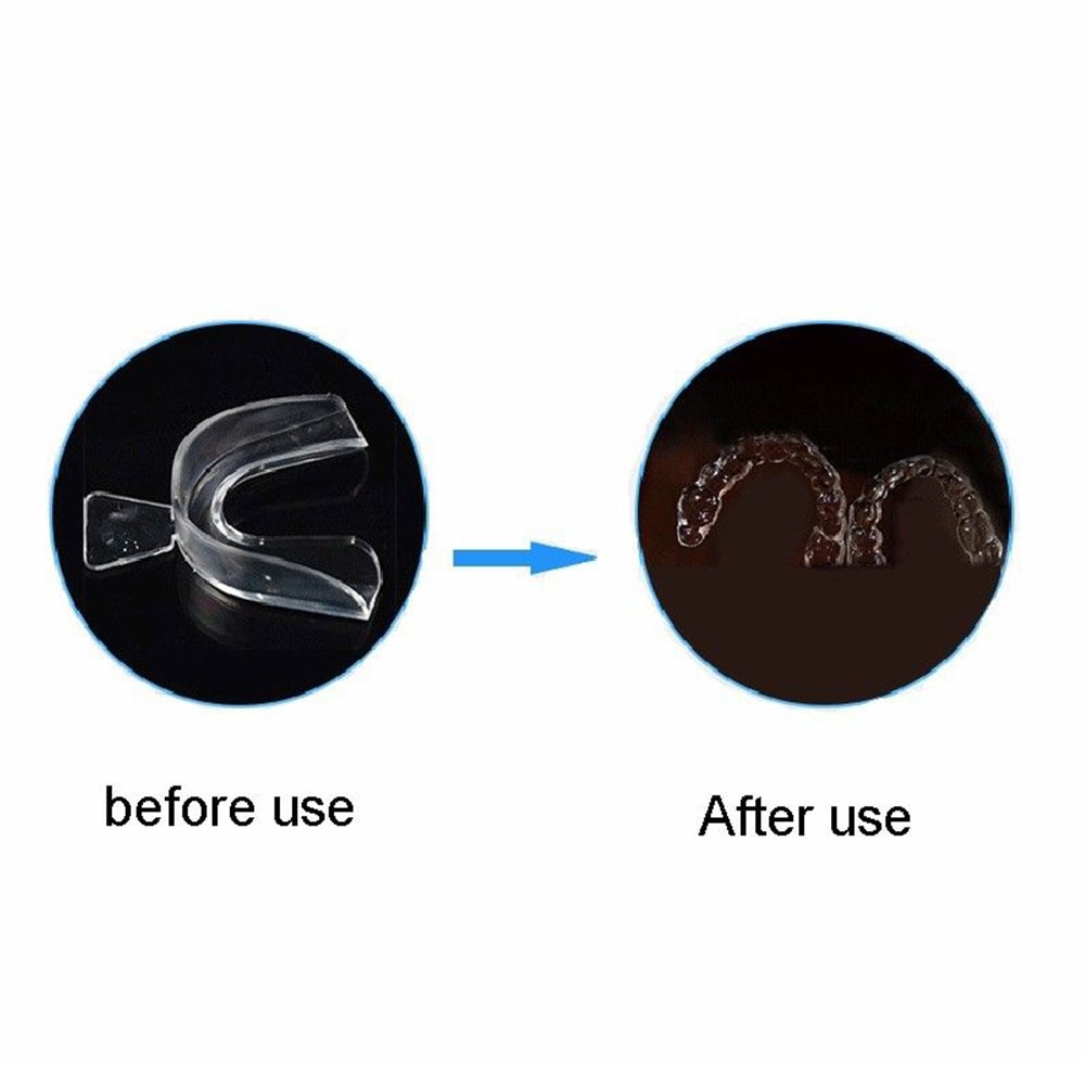 Whitening Teeth Trays 5 Pairs Whitening Teeth Trays 5 Pairs