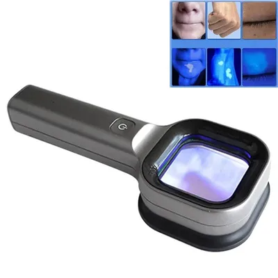 Woods Lamp Skin Analyzer Skin UV Magnifying Skin Testing Home Use Facial Testing Wood Light Face Analysis Detection Woods Lamp Skin Analyzer Skin UV Magnifying Skin Testing Home Use Facial Testing Wood Light Face Analysis Detection