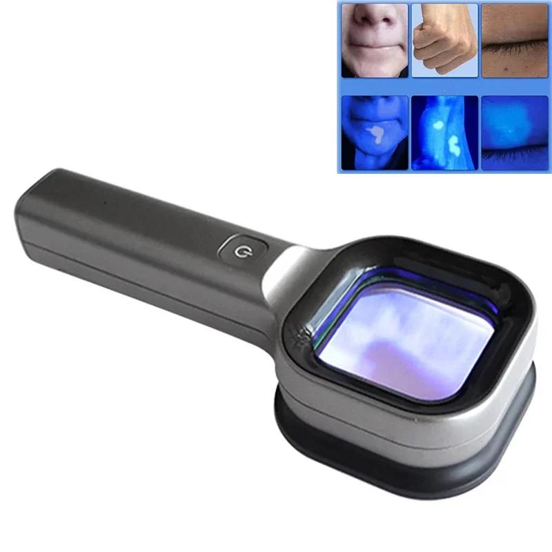 Woods Lamp Skin Analyzer Skin UV Magnifying Skin Testing Home Use Facial Testing Wood Light Face Analysis Detection