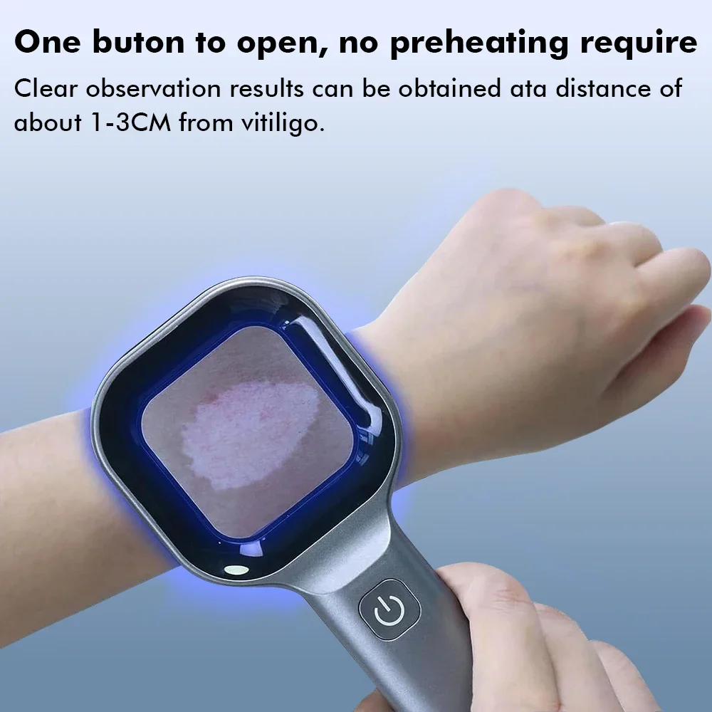 Woods Lamp Skin Analyzer Skin UV Magnifying Skin Testing Home Use Facial Testing Wood Light Face Analysis Detection Woods Lamp Skin Analyzer Skin UV Magnifying Skin Testing Home Use Facial Testing Wood Light Face Analysis Detection