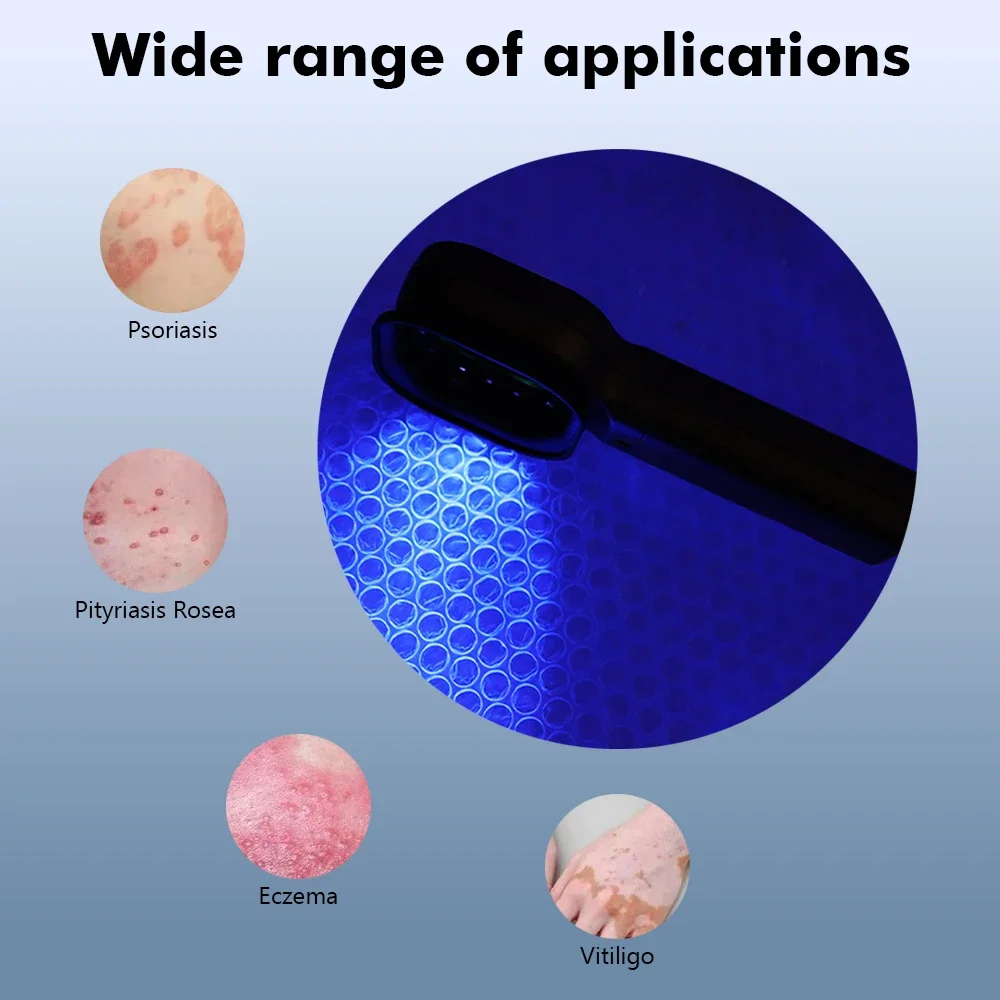 Woods Lamp Skin Analyzer Skin UV Magnifying Skin Testing Home Use Facial Testing Wood Light Face Analysis Detection Woods Lamp Skin Analyzer Skin UV Magnifying Skin Testing Home Use Facial Testing Wood Light Face Analysis Detection